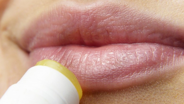 8 CRITICAL COLD SORE STAGES