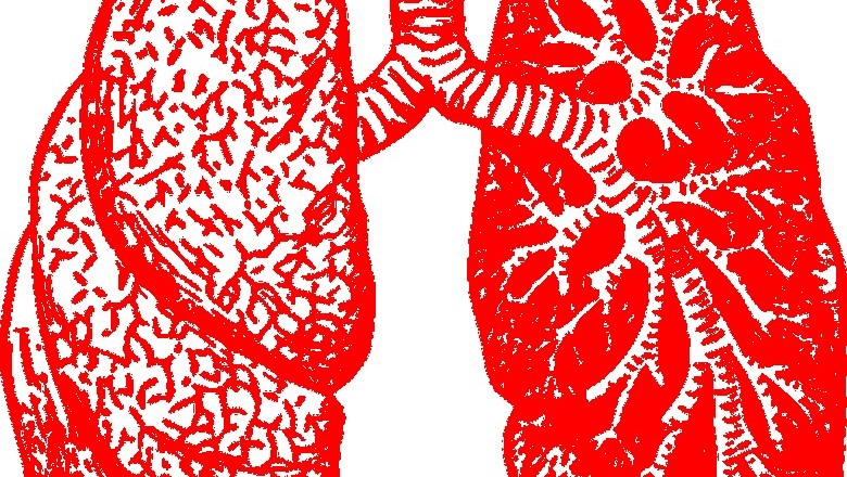 Diagnosing bronchitis