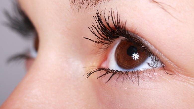 Blepharitis Treatment without Medicine