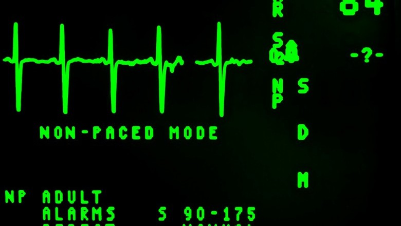 the-meaning-of-abnormal-ekg-results-article-alley